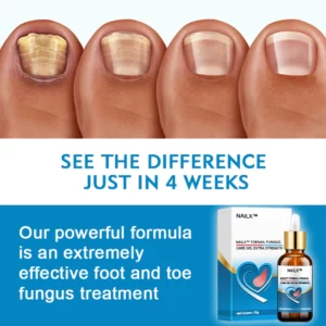 NailX™ Toenail Fungus Care Gel Extra Strength