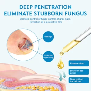 NailX™ Toenail Fungus Care Gel Extra Strength