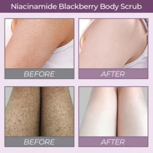 Niacinamide Blackberry Body Scrub