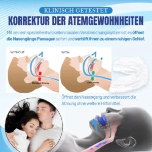 NightBite™ Kieferanpassungsspange