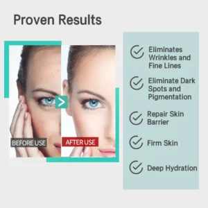 Nuves™ MMP Anti-Wrinkle Antioxidant Serum