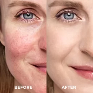 O’MELIN™ Placenta Dragon's Blood Brightening Cream