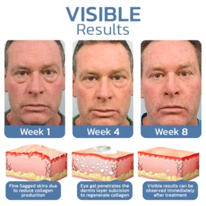 OPENEYES Awaken Peptide Liftende Ooggel