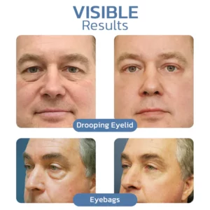 OPENEYES Awaken Peptide Liftende Ooggel