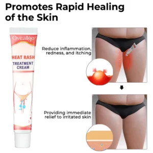 Oeallgo™ Heat Rash Treatment Cream