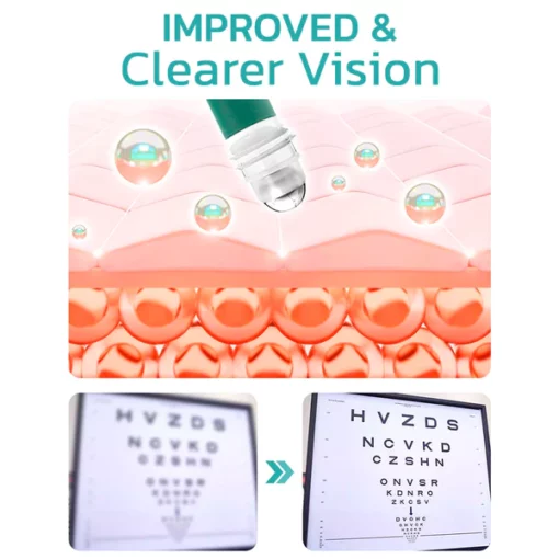 OphthlaMed Vision Enhance Roller