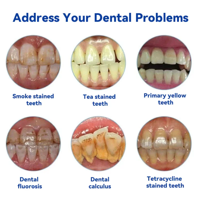 معجون أسنان أوراليز ™ مضاد للتسوس لصحة اللثة