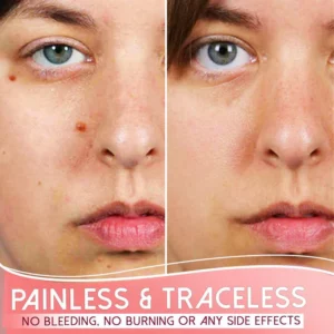 Alternative view of Organic Skin Purifying Dark Spot Serum