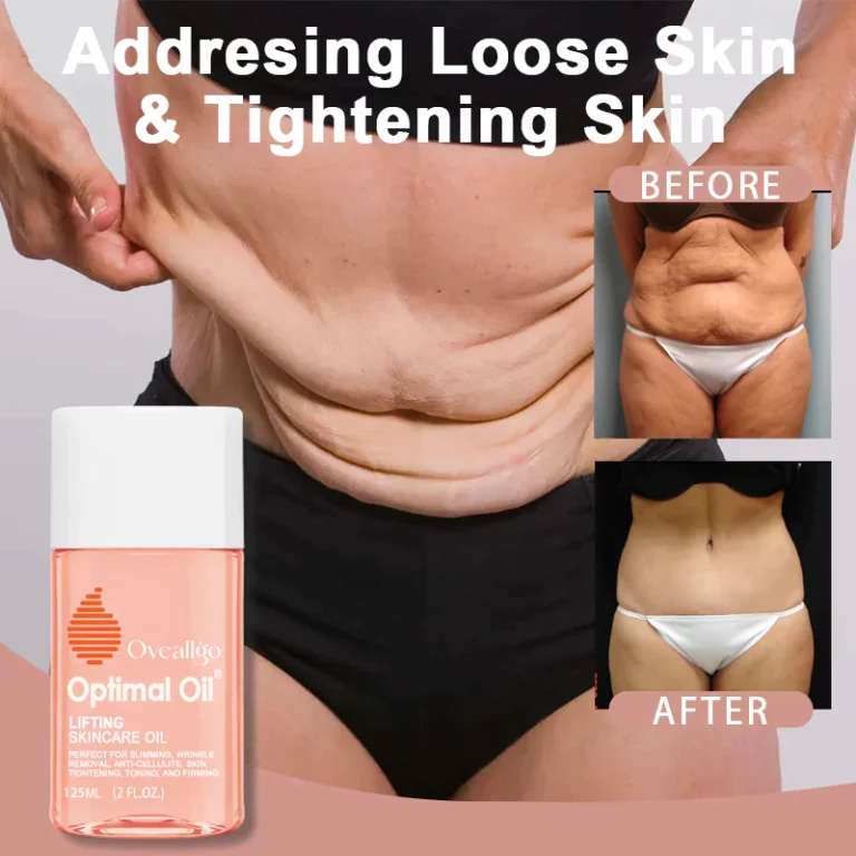 Oveallgo™ Optimal Oil®Collagen Boost שמן לטיפוח העור