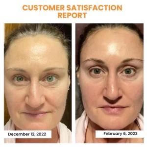 OveallgoTM Korean Technology Soluble Collagen Film