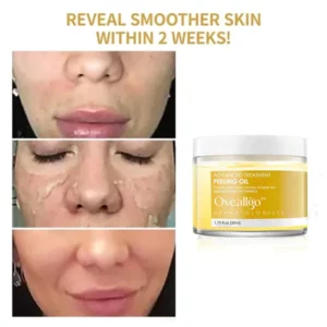 Oveallgo™ 30 Days Anti-Wrinkle Exfoliate Peeling Oil
