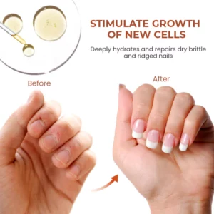 Oveallgo™ 7 Days Maximum Strength Nail Repair Serum