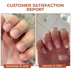 Oveallgo™ 7 Days Maximum Strength Nail Repair Serum