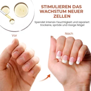 Oveallgo™ 7 Tage Maximale Stärke Nagel-Reparatur-Serum