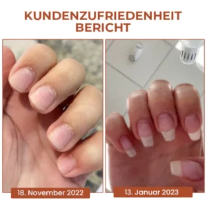 Oveallgo™ 7 Tage Maximale Stärke Nagel-Reparatur-Serum