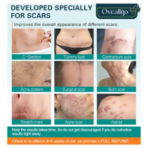 Oveallgo™ Advanced Scar Removal Spray