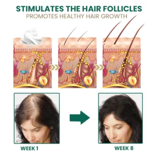 Oveallgo™ Glamor Ginger Essential Hair Growth Cream