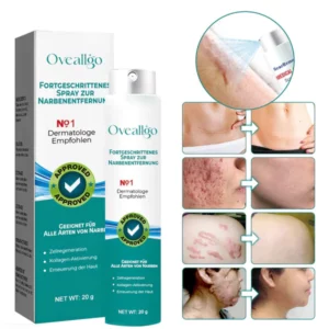 Oveallgo™ LUX Fortgeschrittenes Spray zur Narbenentfernung