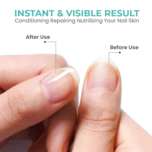 Oveallgo™ Rich Vitamin Nail Strengthening Cuticle Oil