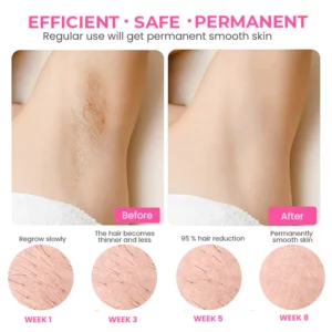 Oveallgo™ SmoothSweep Beeswax Hair Removal Mousse