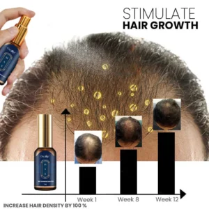 Oveallgo™ VENUSKISS Hair Stimulating Spray MAX