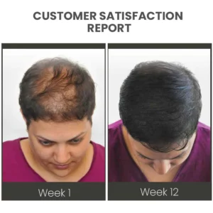 Oveallgo™ VENUSKISS Hair Stimulating Spray MAX