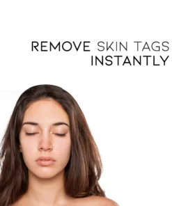 Oveallgo™ WipeOff Tags & Moles Remover