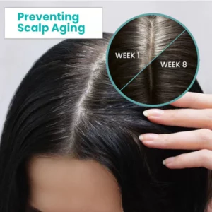 Peaufit™ ScalpReboost Ultra NMN Hair Growth Roller