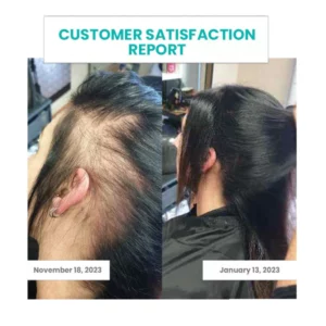 Peaufit™ ScalpReboost Ultra NMN Hair Growth Roller