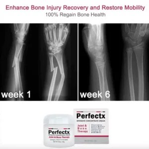 PerfectX Joint And Bone Therapy Cream