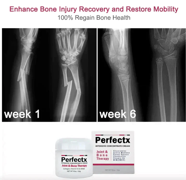 PerfectX krema za terapiju zglobova i kostiju