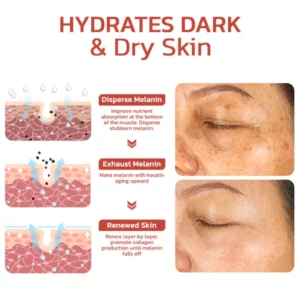 Pigment Correcting Cream