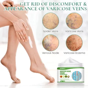 RENEW Varicose Veins Cream