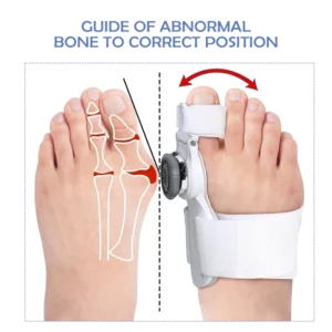 Ricpind StraightToe Adjustable BunionCorrector