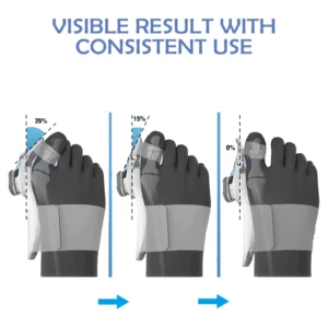 Ricpind StraightToe Adjustable BunionCorrector