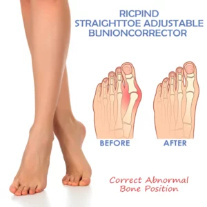 Ricpind StraightToe Adjustable BunionCorrector