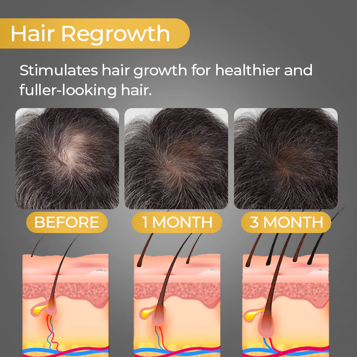 SEVICH™ natūralus plaukų slinkimą mažinantis šampūnas