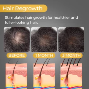 SEVICH™ Natural Anti Hair Thinning Shampoo