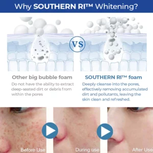 SOUTHERN RI™ Whitening Freckle Removal Cleanser