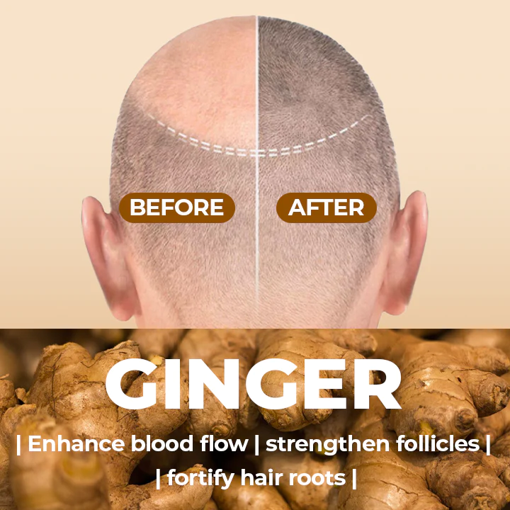 SalonX™ loodusliku ingveri juuksekasvu soodustav šampoon