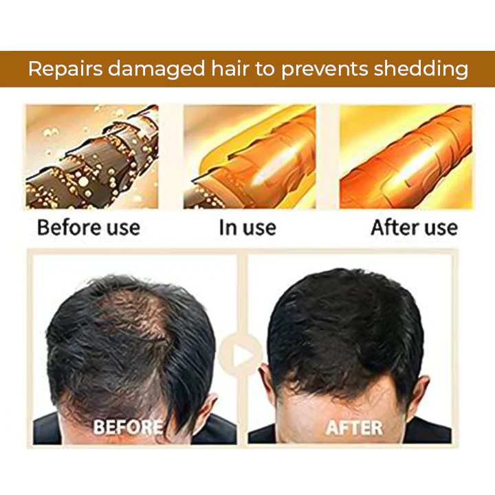 SalonX™ բնական կոճապղպեղով մազերի աճի շամպուն բար