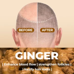 SalonX™ Natural Ginger Hair Growth Shampoo Bar