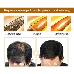 SalonX™ Natural Ginger Hair Growth Shampoo Bar