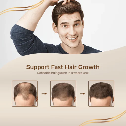 SilverShield™ Anti-Gray Hair Rejuvenating Serum