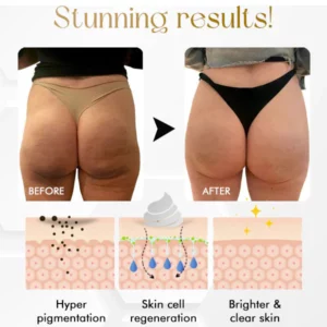 SkinGlow™ Whitening Repair Cream