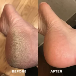 Skinetic™ Colostrum Nicotinamide Long Leg Mask