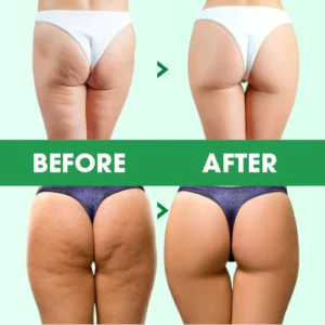 Skintight™ Firming & Slimming Cream