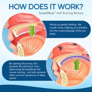 SoundSleep™ Anti Snoring Stickers