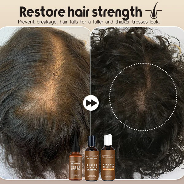 Suupillid ™ Hergroei Afrikaanske Chebe Hair Care Essentials Set