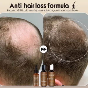 Suupillid™ Hair Regrowth Juego de elementos esenciales para el cuidado del cabello Chebe africano